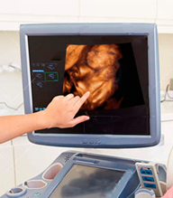 ULTRASONIDO GENERAL, DOPPLER, 3D Y 4D 